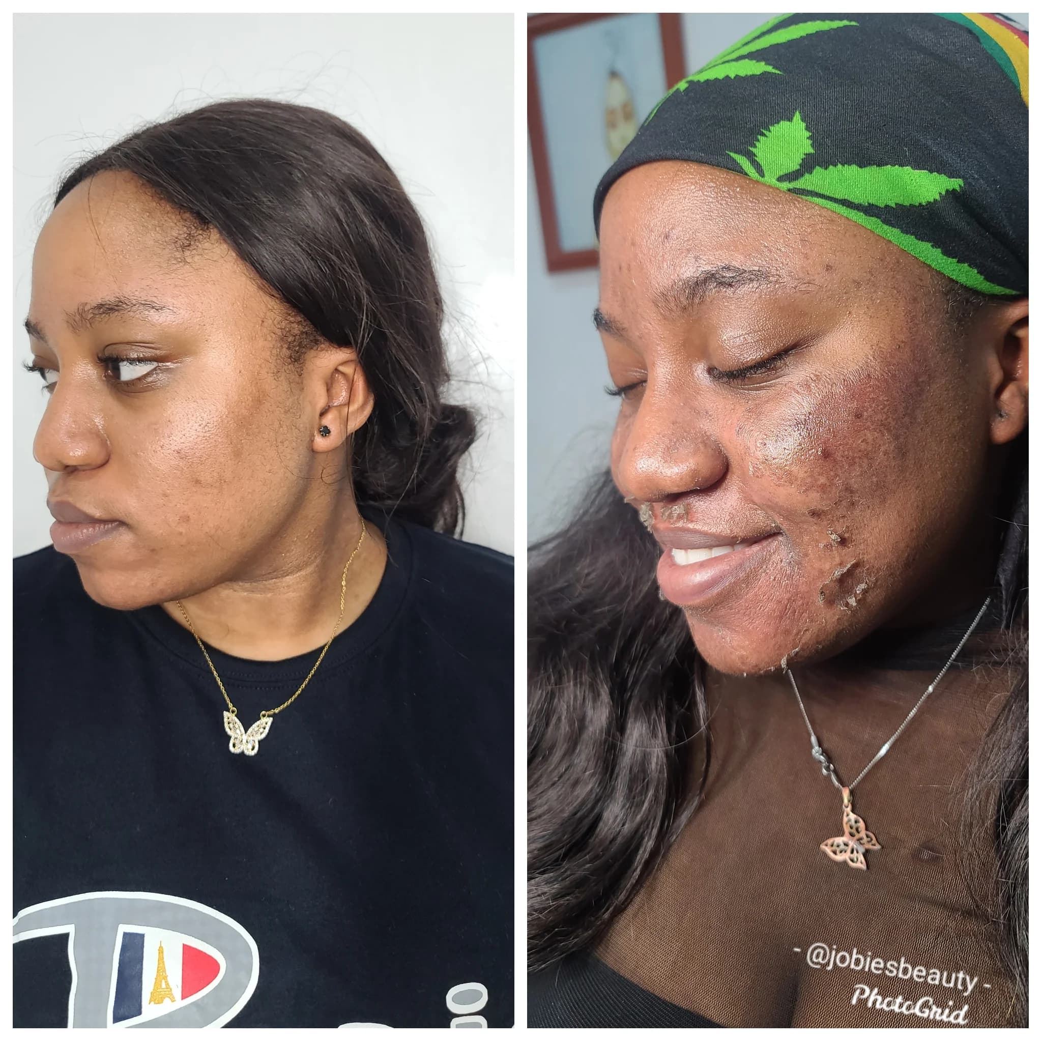 Balance Peel image